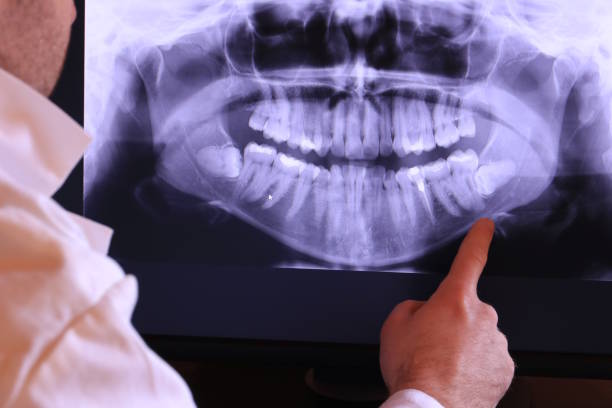 Best Emergency Treatment for Oral Infections in Hebron, NE